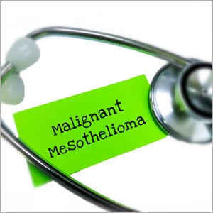 Are All Malignant Mesotheliomas Caused By Asbestos Exposure In Louisiana?