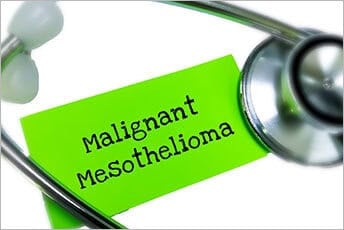 Are All Malignant Mesotheliomas Caused By Asbestos Exposure In Louisiana?